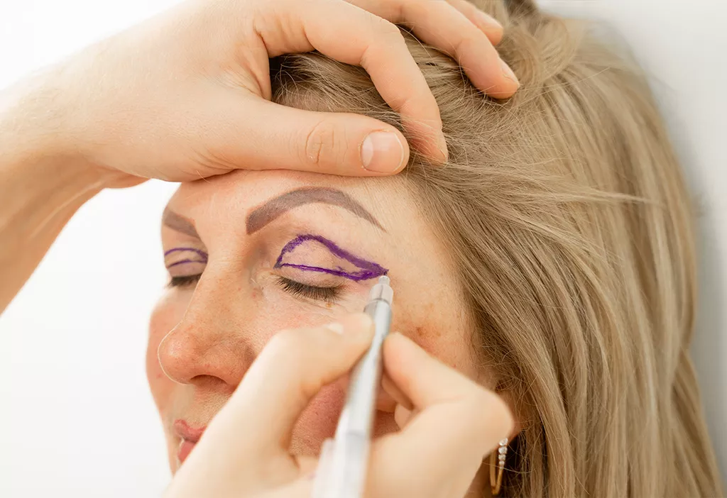 Paupières tombantes