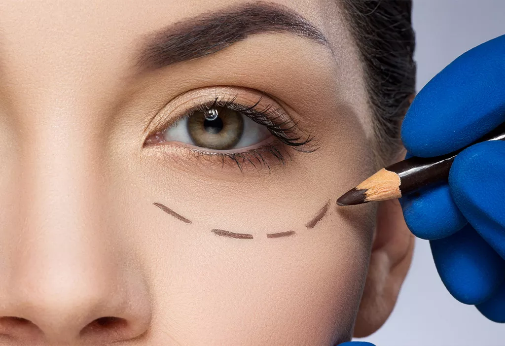 Poches sous les yeux