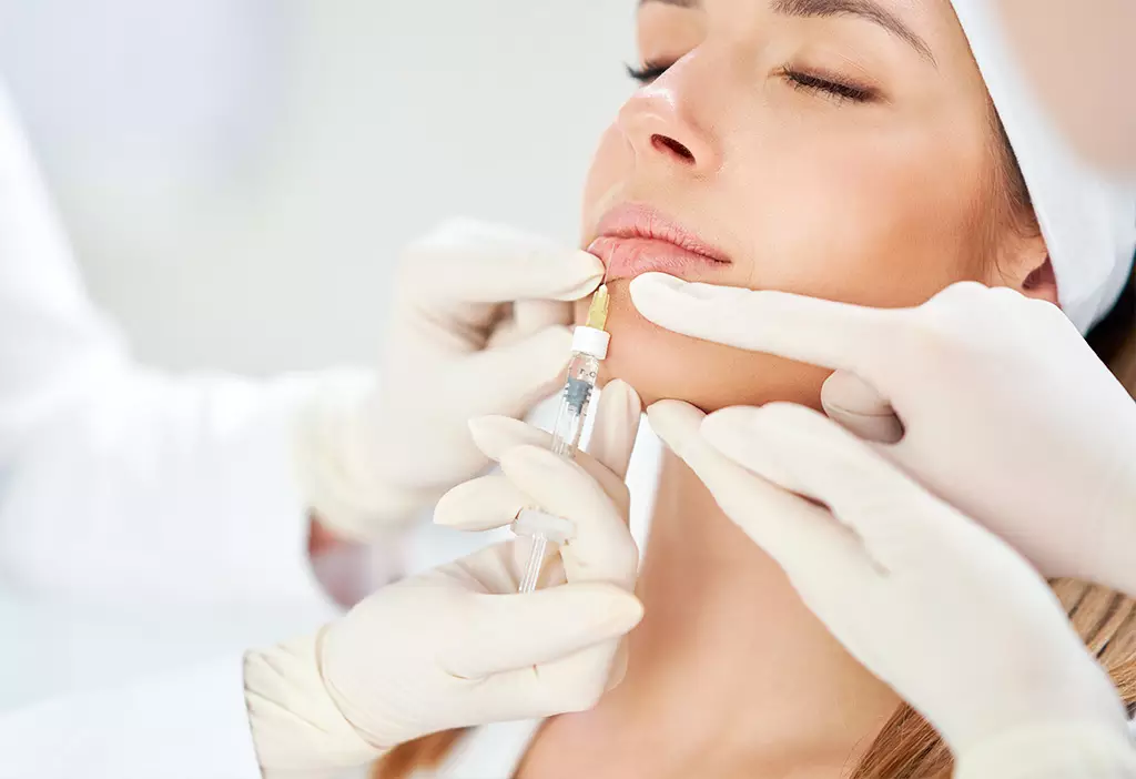 Injection acide hyaluronique