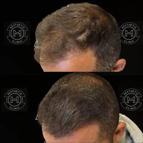 cheveux-2-avant-apres