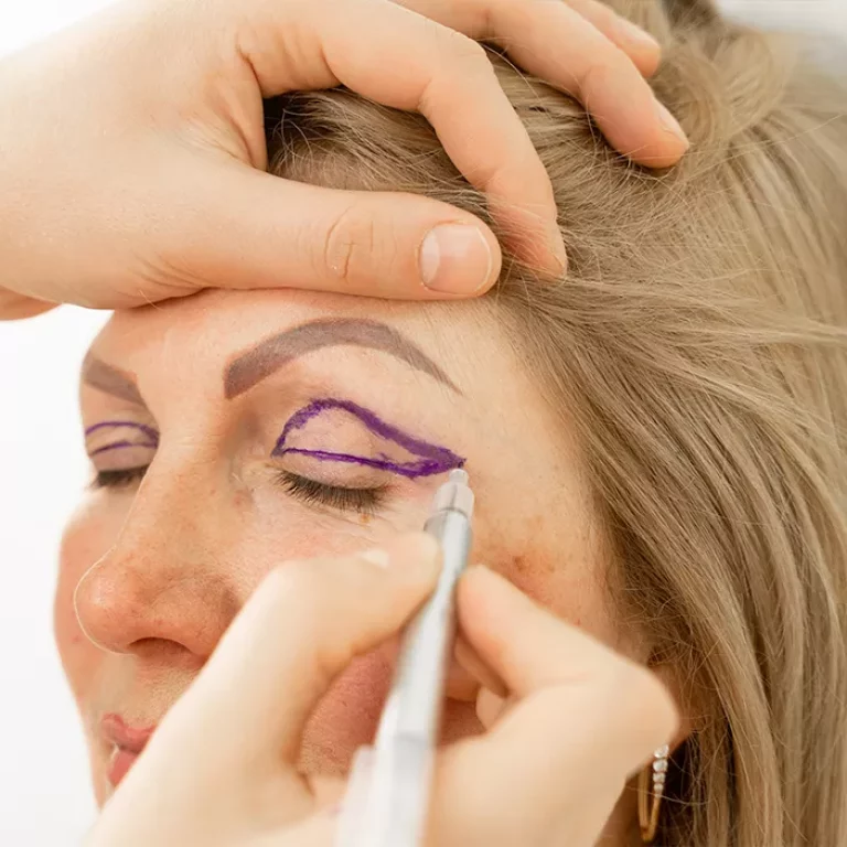 Paupières tombantes