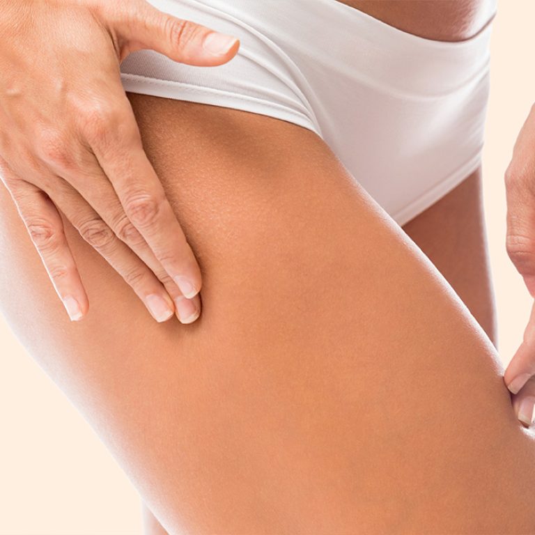 Liposuccion des cuisses