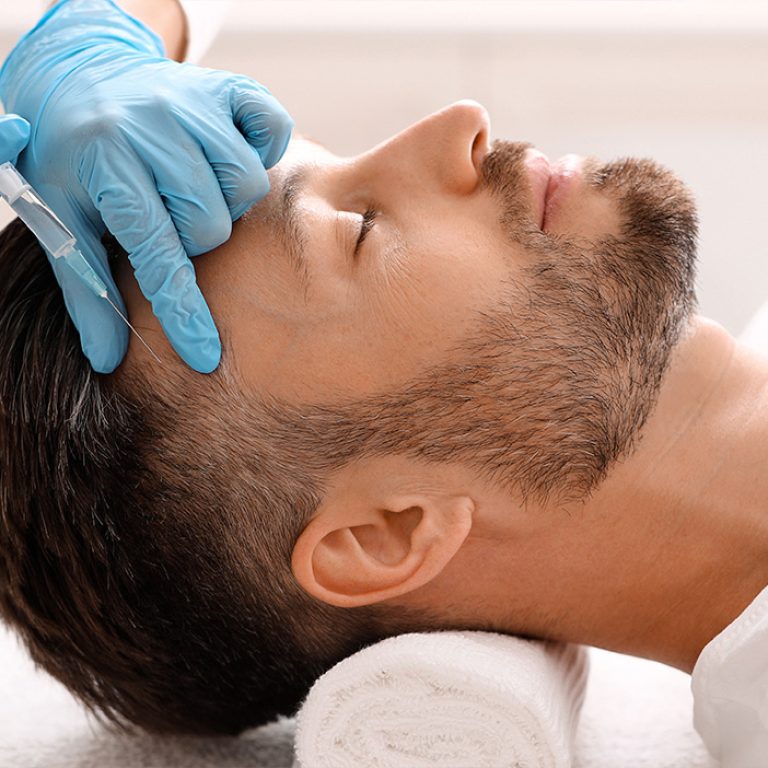 Injections de PRP pour les cheveux