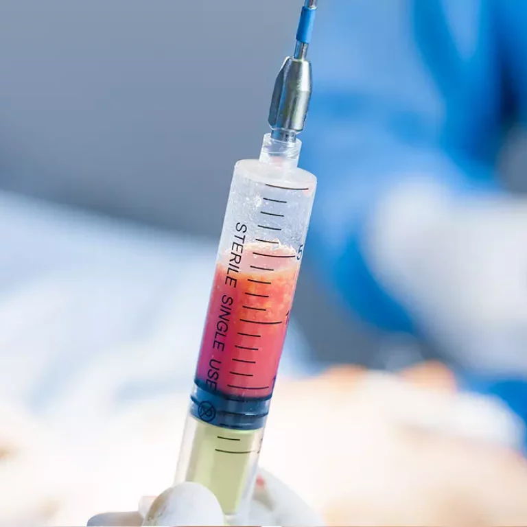 Augmentation mammaire par graisse